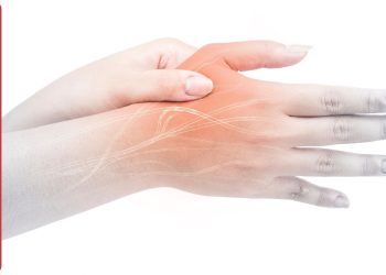 أعراض عصبية